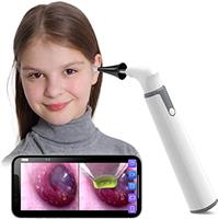 ScopeAround Wireless Otoscope Ear Camera, Ear Wax Removal Kit Camera with 6 LED Lights, 3.9mm Visual Ear Scope for Kids, Adults & Pets, Compatible with Android/iPhone/iPad (White)