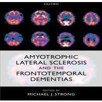 Oxford University Press Amyotrophic Lateral Sclerosis & the Frontotemporal Dementias