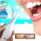 Oral Teeth Floss Dental Water Jet Air Powered Deep Cleaning Flossing System