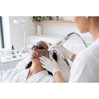 PRICE DROP! Carbon Laser Facial Treatment - Face & Neck Sessions Available - London