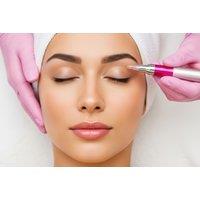 Eyelid or Frown Line Plasma Pen Treatment - 2 Locations incl Harley Street