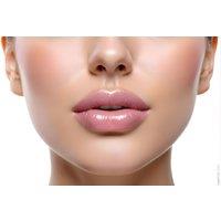 1ml Dermal Lip Filler Treatment at Vital Aesthetics - Sutton Coldfield