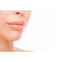 2ml Dermal Lip Filler at Cosmetic Doctors - 7 Locations Across London & Surrounds