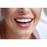 30-Minute Dental Hygiene Appointment with Scale & Polish at Leyton Dental Surgery, On-Site - London