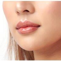 1ml Lip Filler Treatment at Glorious Skin Clinic - Leeds