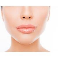0.5ml or 1ml Lip Filler Treatment at Nurse Ebony Aesthetics, London