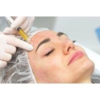 PRP Vampire Facial & LED Therapy - 1 or 3 Smoothing Treatments at KLC Well-Being For All, Wigston