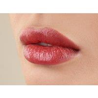 1ml Dermal Filler Treatment for Lips, Cheeks, Nasal & More at Michele Osmak Aesthetics - Newport