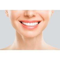 60-Minute Laser Teeth Whitening Session at Haus of Skin - On-Site Treatment in Stoke-on-Trent