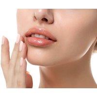 Lip Filler Treatment - 0.5ml or 1ml at Permanent Aesthetics Studio, 2 Locations, Derby