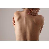 Mole, Skin Tag or Wart Removal for Small, Medium or Large Area at 1118 IPL and Beauty Salon, Leicester
