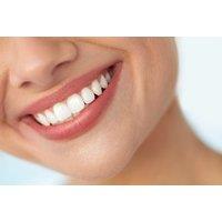 Professional Teeth Whitening Session at Pebble Brook Clinic - On-Site Treatment in Exeter
