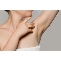 Hyperhidrosis Underarm Treatment with Consultation at Rejuvenate Aesthetics, Wolverhampton