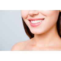 Laser Teeth-Whitening Treatment At Nebras Clinic, On-Site In Kensington, London