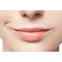 Lip Filler Dissolving Session at Glorious Skin Clinic, Leeds