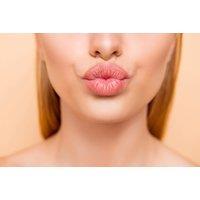 Russian Lip Filler - 0.5ML, 1ML or 1.5ML - Bournemouth