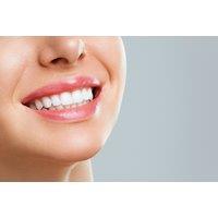 Laser Teeth Whitening - 1 Or 3 Sessions At Mezzical Aesthetics, On-Site In Leeds
