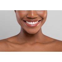 Custom-Fit At-Home Teeth Whitening Trays & Gels By Tuxford Oral Health Care - Derby