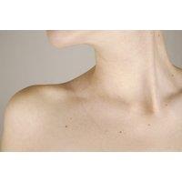 Skin Tag, Brown Spot & Milia Removal Treatment at Face Aesthetic Clinic - Birmingham