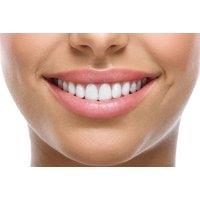 Dental Hygiene Appointment With Scale & Polish Or Airflow Stain Removal - Harley Street, London