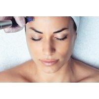 Microneedling Facial at Clarissa K Beauty - Personalised Collagen-Boosting Treatment, Blackpool