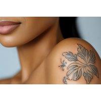 3 Sessions Tattoo Removal - Small, Medium or Large Area at SHAPINS Clinic, Farnham