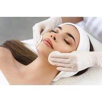 60-Minute Lemon Bottle Microneedling Facial at Vee's Aesthetics - Hodge Hill, Birmingham