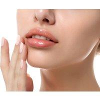 1ml Lip Filler Treatment with Refreshments at My Choice Aesthetics, Burnley