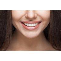 Laser Teeth Whitening With Optional Airflow Stain Removal - 1-Hour In-Clinic Treatment At Waldron Dental (3 London Locations)