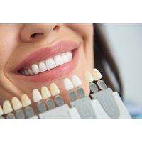 60-Minute Laser Teeth Whitening Session With Aftercare At Migas Beauty Lab - On-Site In London