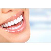 60-Minute Laser Teeth Whitening Session With Aftercare At Migas Beauty, Manchester - On-Site Treatment