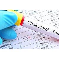 At-Home Cholesterol & Lipid Health Mot Blood Test Kit - Comprehensive Cardiovascular Check - Medtech Services Ltd