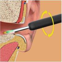 Professional Wireless Visual Ear Wax Removal Kit - Beauty Tool For Precision Ear Care