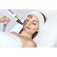 Carbon Laser Peel with Cooling Mask - 45-Minute 4-Step Facial at Laser Treat Esthetica, London