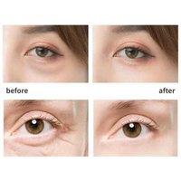 Warm Eye Massager For Dark Circle Relief & Fine Line Care