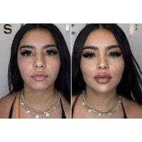 30-Minute HydraFacial Session at Mezzical Aesthetics - 3 Locations