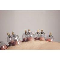 60-Minute Cupping Treatment - Choice of Fire or Dry - 24 Cups - Leicester