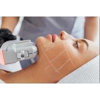 EMSculpt Muscle Stimulation - Choice of Area - Bayswater
