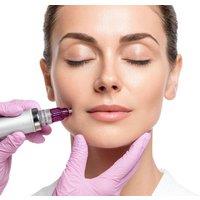 60 Minute Microneedling Facial - Birmingham