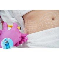 1 Session of Aqualyx Fat-Dissolving Injections or Aqualyx 360 - Raquel Menezes Aesthetics, Northampton
