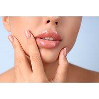 0.5ml, 1ml, or 2ml Lip Filler Enhancement - Bluebird Dentistry & Aesthetics - Acton.