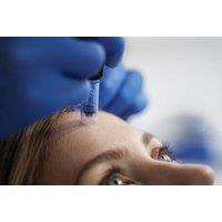 Microneedling Facial or Skin Peel Treatment - Aesthetics Works, Essex