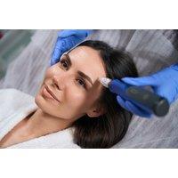 Microneedling Facial from Sculptsure