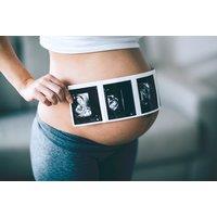 3D & 4D Baby Scan with Fetal Health Check, Keepsake Prints, and Gender Confirmation - South Shields