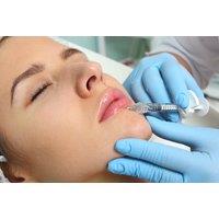 0.5ml, 1ml or 2ml Dermal Lip Filler Treatment with Consultation at London La Beauty - Central & East London