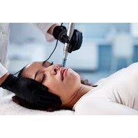 Microneedling Facial Treatment - Shapins Clinic Kensington