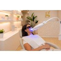 60-Min UV Teeth Whitening Session - The Gloss, London