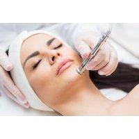 Professional Microdermabrasion Facial - Aesthetics By Faith, Brentwood