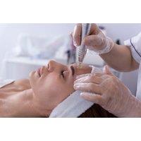 Up to 60-Min Medical-Grade Dermapen Microneedling Treatment - Accurate Laser, London
