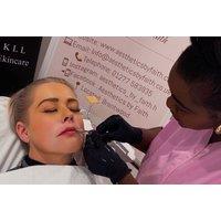 0.5ml or 1ml Lip Filler Enhancement - Aesthetics by Faith, Brentwood